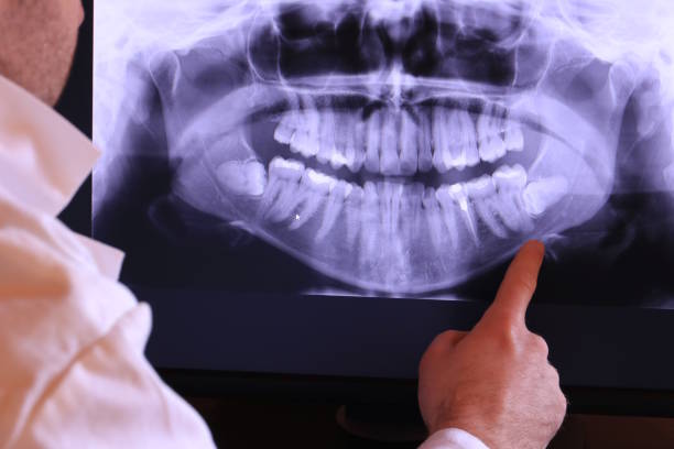 Best Emergency Dental Filling Replacement  in Red Oak, TX